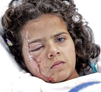  هويدا خالد بعد العملية