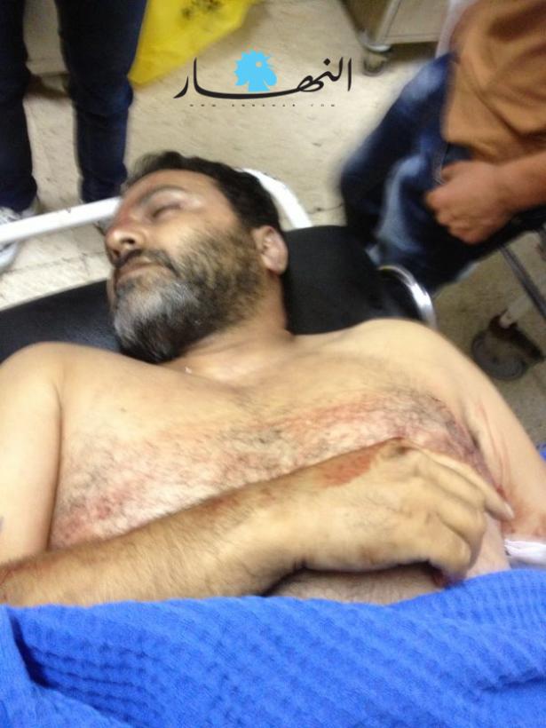  المواطن محمد عبس أصيب  في باب التبانة خلال اطلاق نار ابتهاجاً بتفجير الضاحية