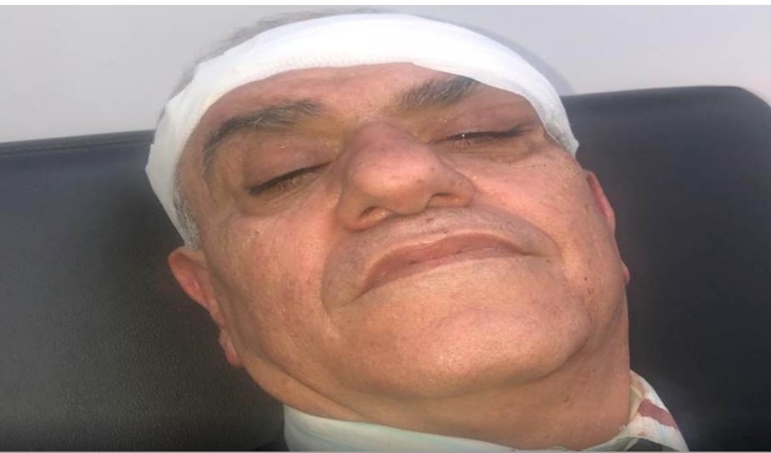 المهندس المتقاعد حيدر عثمان بعد معالجته في المستشفى