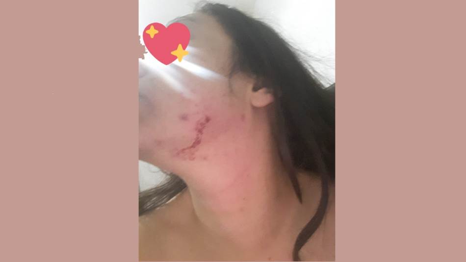 صور متداولة للضحية غنوة علاوي تظهر آثار العنف على وجهها (تويتر)