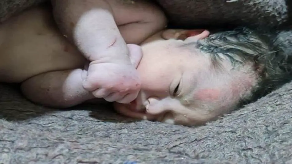 الرضيعة آية بعد إنقاذها