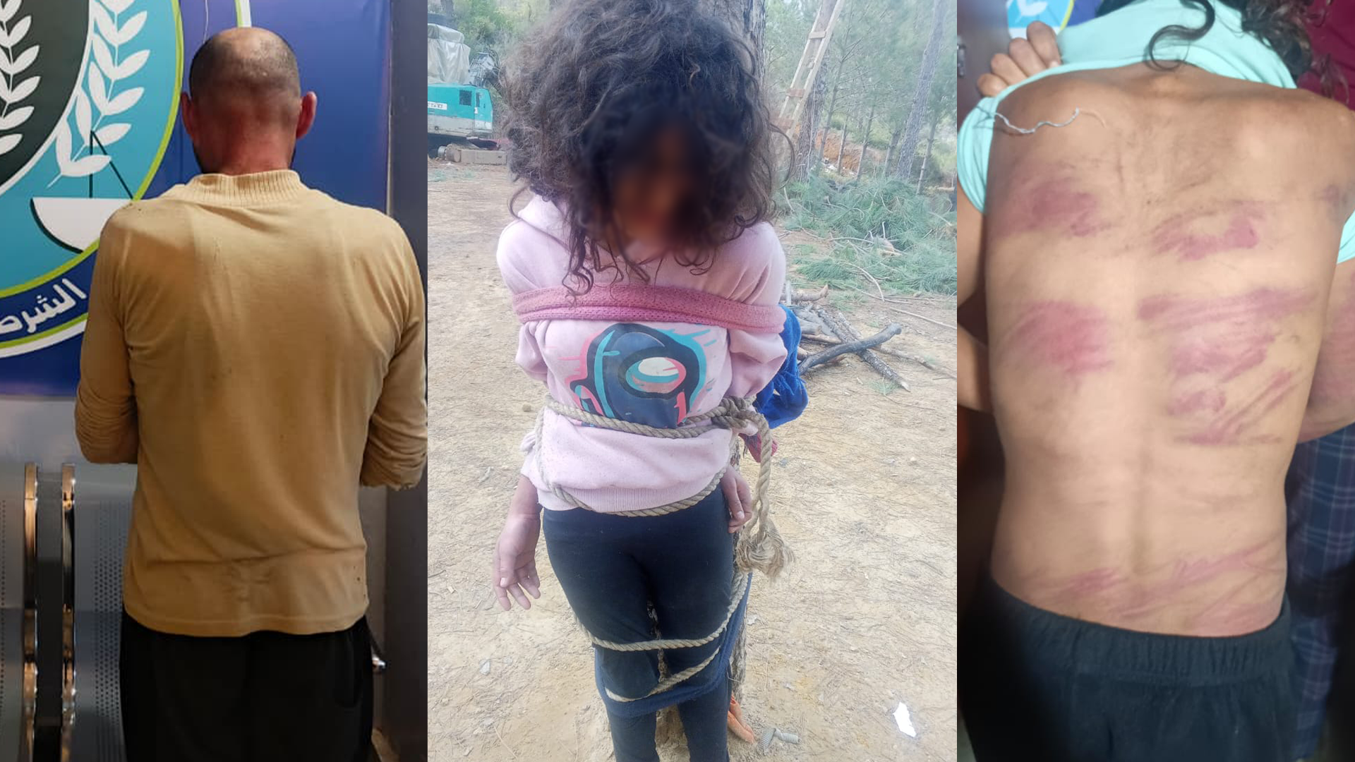 استخدم الموقوف أدوات حادة وكابلات كهربائية في تعذيب أفراد أسرته